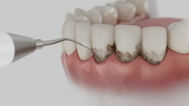Reliable Dental contractor in Sausalito, CA by Dentist Open Now